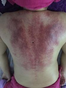 刮痧视频教程全集背部,轻松掌握健康养生之道